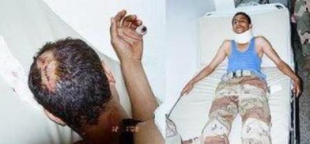 الجريحان من جنود الأمن اللذين نقلا إلى صنعاء للعلاج