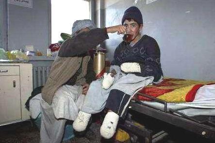 والد يسقى ابنه الشاي بعد أن قطعت  يداه وقدماه بسبب البرد القارص في هرات