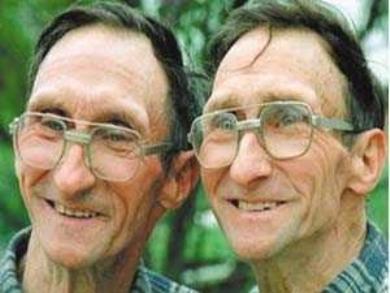 في الصورة جون ووليام ريف، اللذان أوردتهما موسوعة جينيس للأرقام القياسية العالمية ذات يوم كمتصدرين لقائمة التوائم الاكثر تطابقاً على مستوى العالم