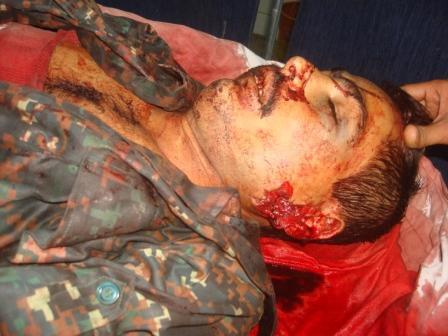 الجندي القتيل / محمد علي عبد السلام الملكي الذي استشهد أمس