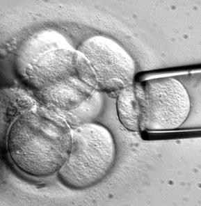 خلاية جذعية