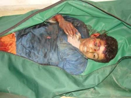 الأطفال لم يسلموا من الأعمال البشعة لعناصر الإرهاب في صعدة