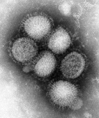 فيروس (إتش1إن1) تحت المجهر الالكتروني في صورة حصلت عليها رويترز من مراكز مكافحة الأمراض والوقاية منها في اتلانتا يوم 28 ابريل 2009