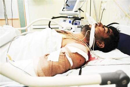 احد المصابين جراء تفجيري زاهدان يتلقى العلاج في مستشفى في المدينة الواقعة بجنوب شرق ايران يوم أمس  الجمعة