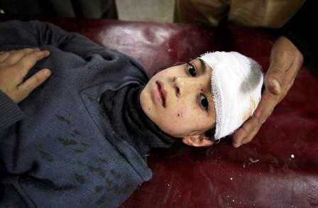 طفلة مصابة اثر انفجار حافلة مدرسية في مدينة بيشاور بشمال غرب باكستان
