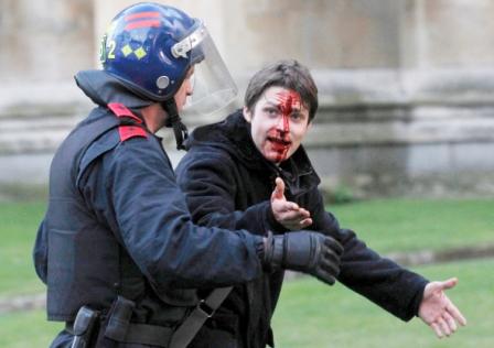 أحد المصابين من الطلاب المحتجين على قرار رفع رسوم الدراسات الجامعية أمس