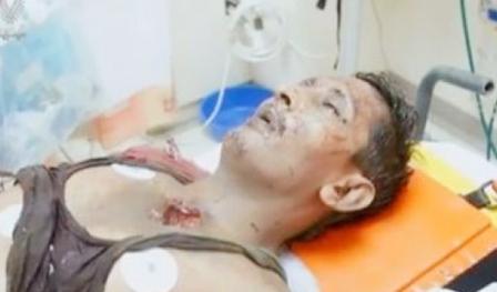 أحد المصابين في انفجارات المنامة