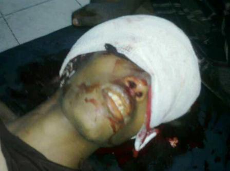 صورة رقم 2: الشاب درويش صريعاً بعد مقتله برصاص أخرج دماغه من رأسه